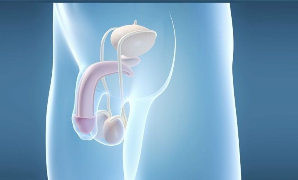 Implantation is a surgical method to enlarge the male penis